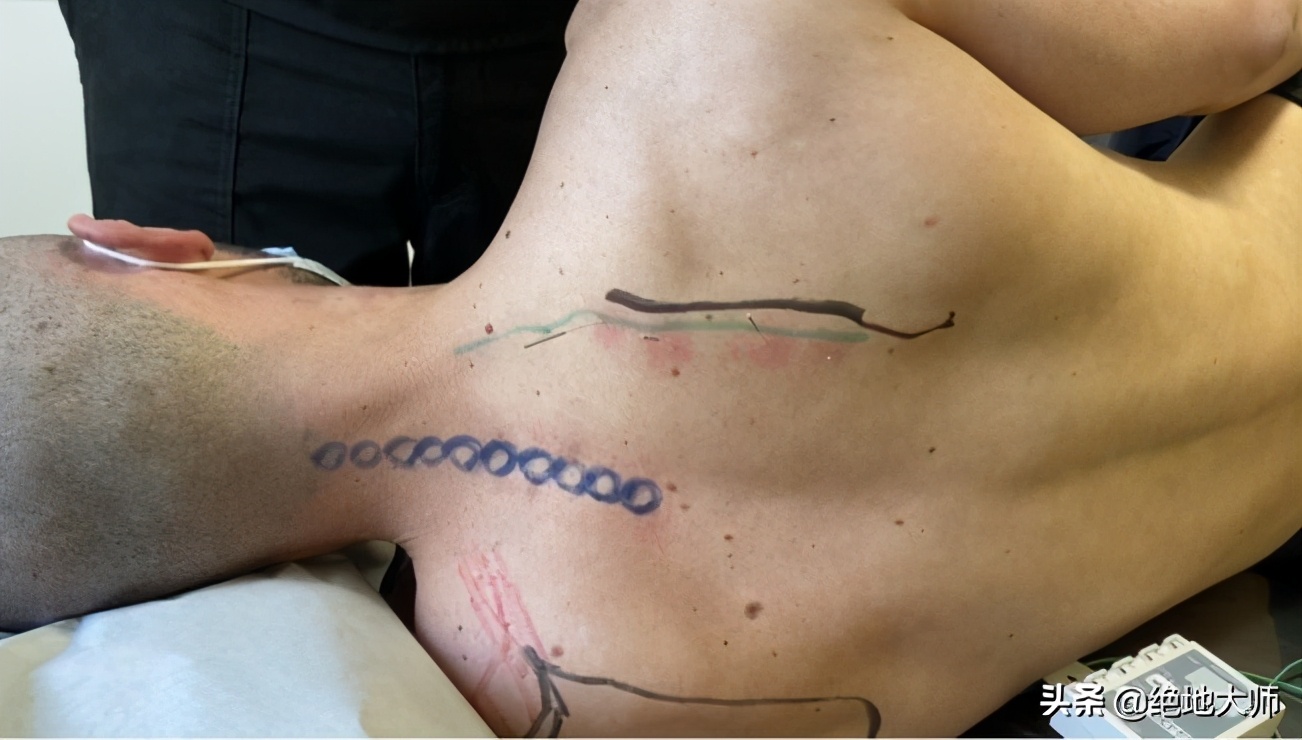 慢性颈痛推拿手法,慢性颈肩腰腿痛中医调养视频