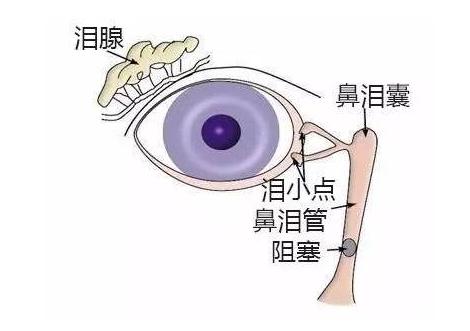 孩子眼屎多医生教你如何降火,宝宝流泪有眼屎用什么眼药水