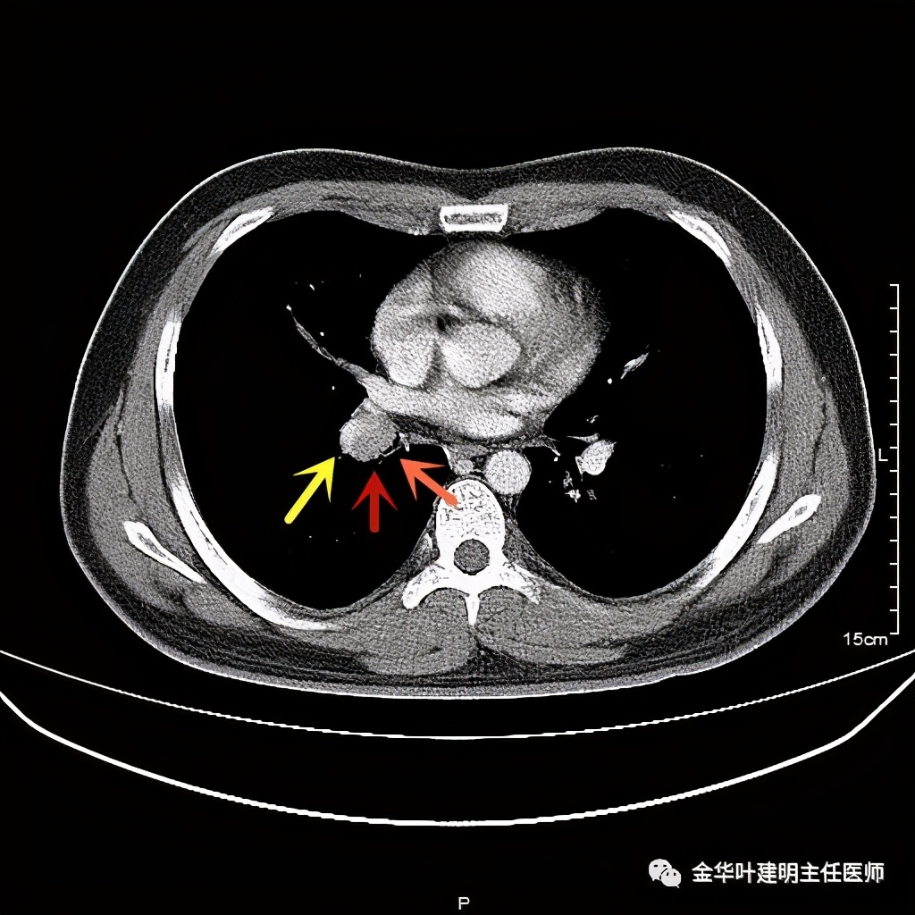 放个大招完整版教学,放个大招完整版前奏