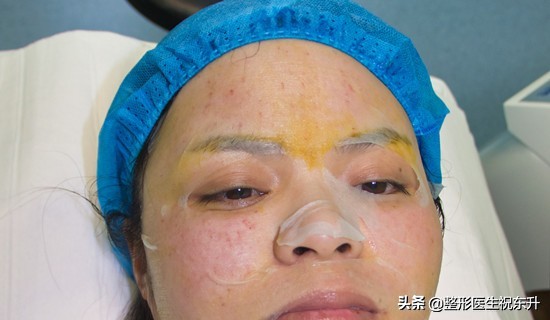 听医生讲养生,水光针为您祛除肤质困扰