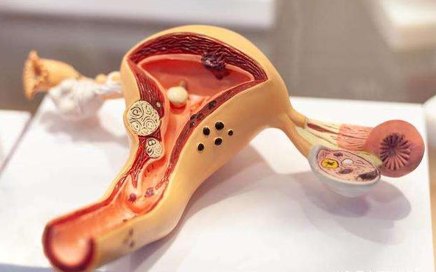 为什么有些女的没有子宫,为什么没有卵巢和子宫