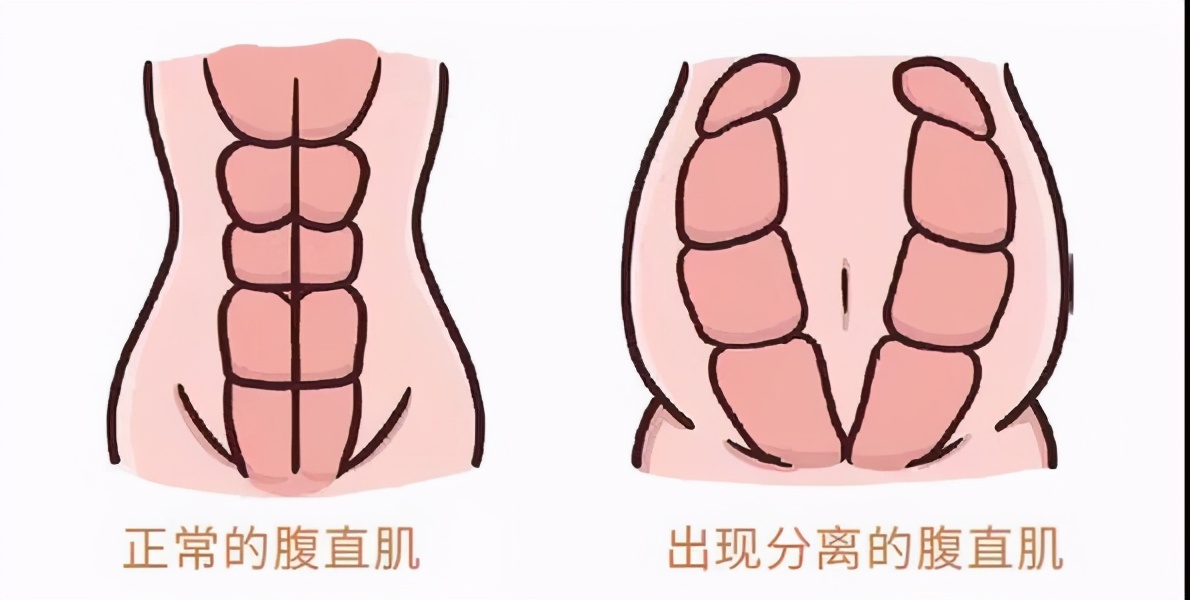 宝妈产后常遇到的问题,产后宝妈经常出现的身体问题