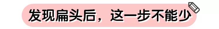 宝宝扁头如何变饱满,宝宝头型为什么要扁头