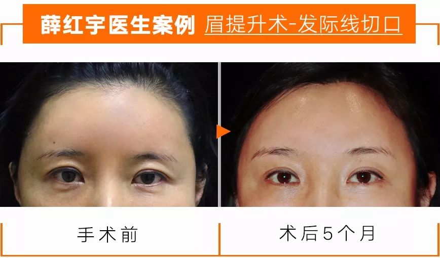 明星逃不过的年龄,眼睛衰老比较明显的明星