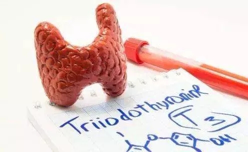 促甲状腺激素0.115是甲亢还是甲减,促甲状腺激素偏高多少才算甲减