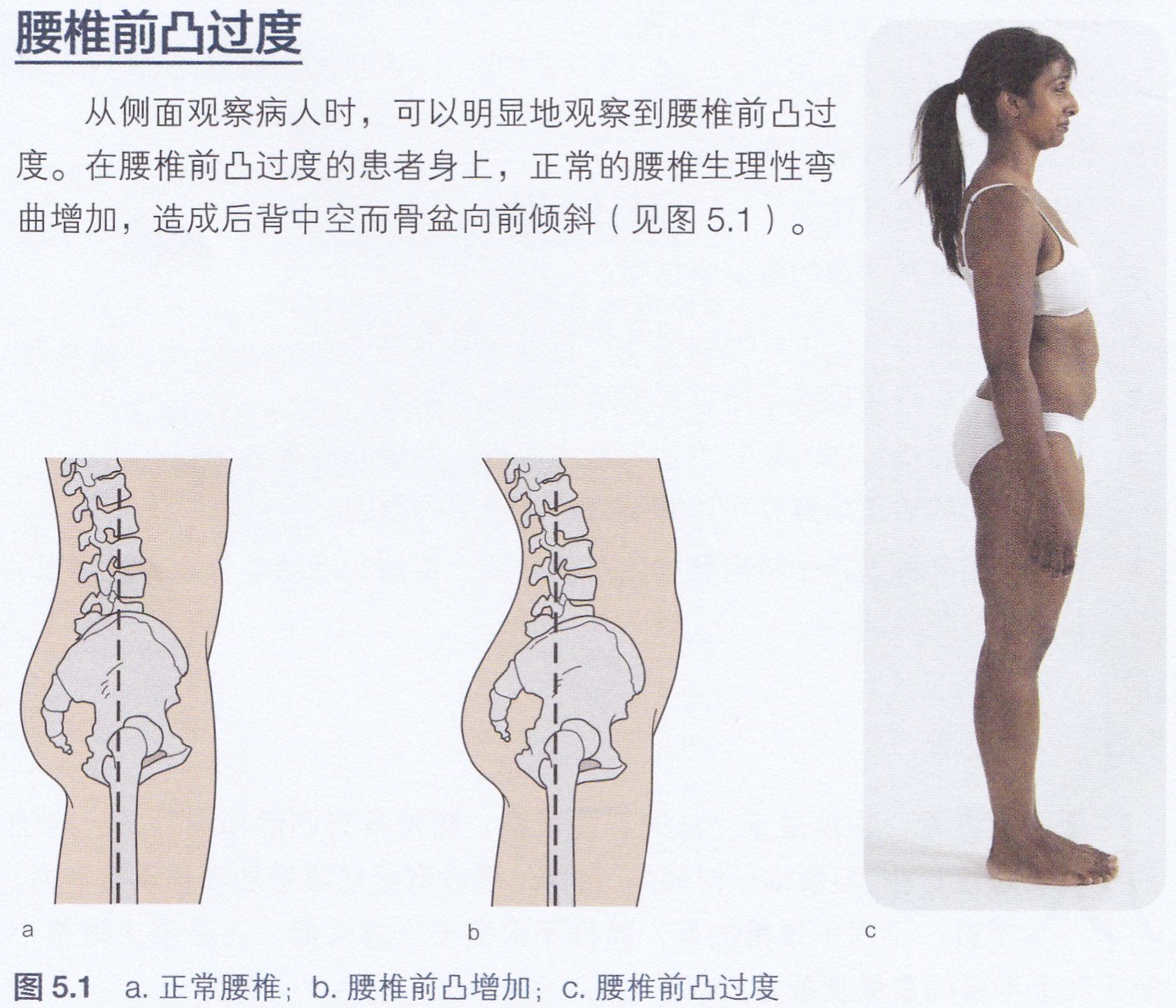 脊柱保持中立位是什么意思,脊柱中立位的标准动作