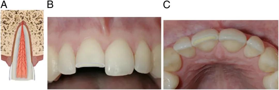宝宝磕掉乳牙还能再长吗,宝宝磕掉牙会长出来吗