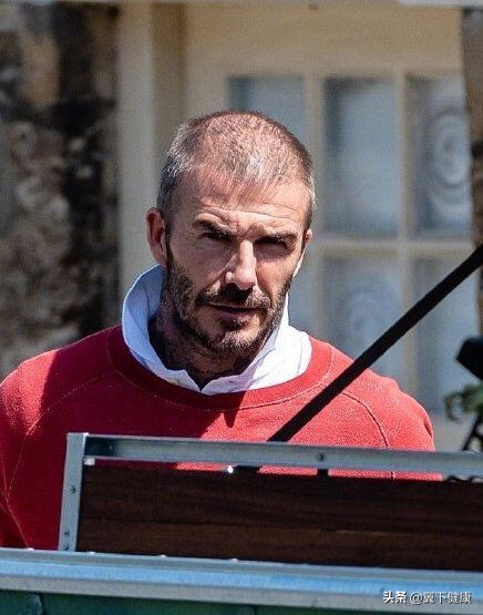 如何才能预防和治疗秃头,年纪轻轻就秃头了怎么办