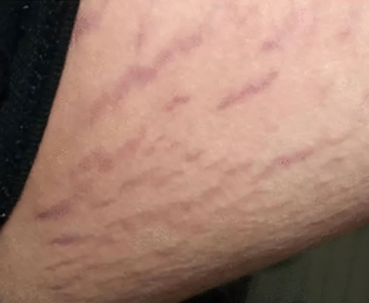 十六岁的男孩精神分裂症的前兆,14岁精神分裂症妄想症有哪些表现