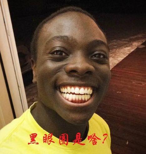 医学博士说眼霜真的治疗黑眼圈吗,真正对黑眼圈有用的眼霜