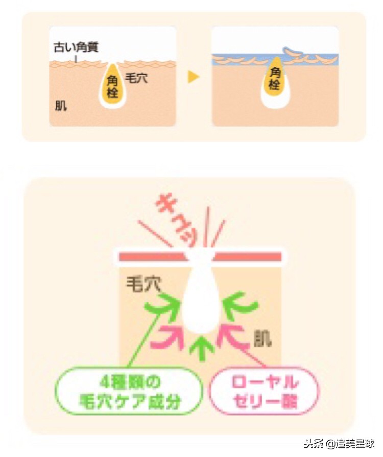 城野医生毛孔收敛水可以敷脖子吗,城野医生毛孔收敛水对痘痘有用吗