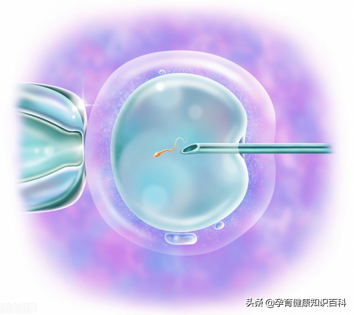精子畸形率99%能自然怀孕吗,精子畸形率95%能自然怀孕吗