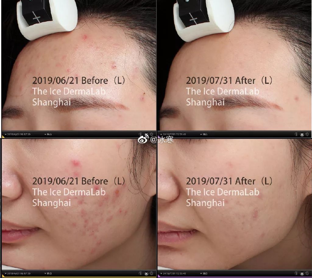 30分钟去黄提亮,变身白美人!皮肤学博士为它强力打call