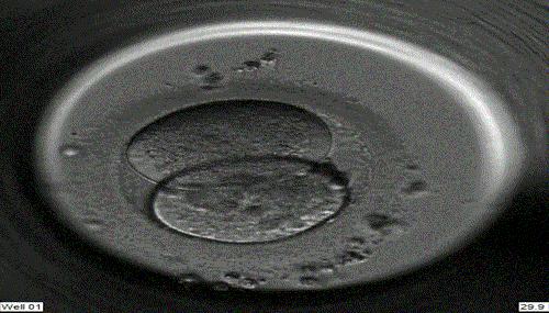 试管解密——精子卵子如何在医生巧手下受精？