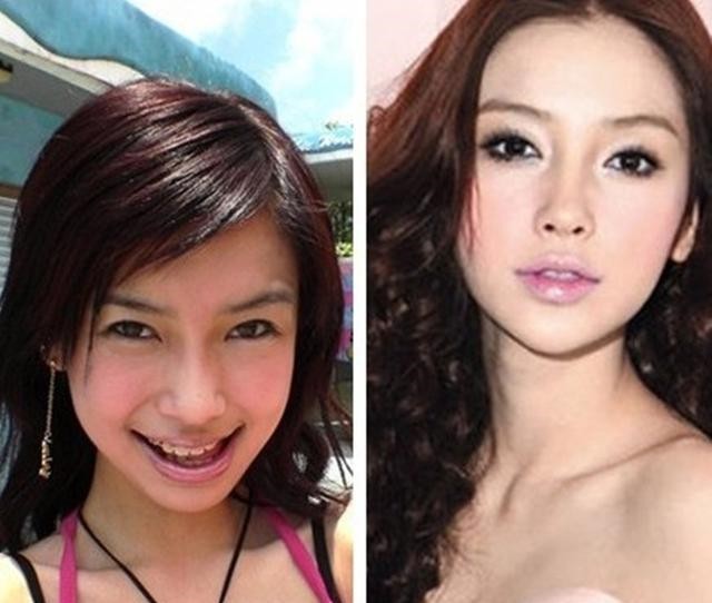 杨紫现身整形美容医院被嘲，牙齿矫形算不算整形？