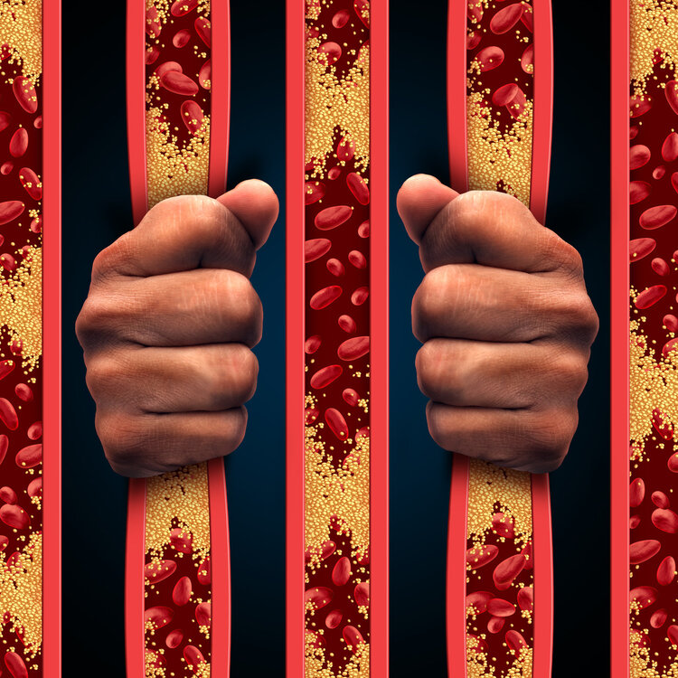 冠心病、高血压、高血脂之间也玩“俄罗斯套娃”?