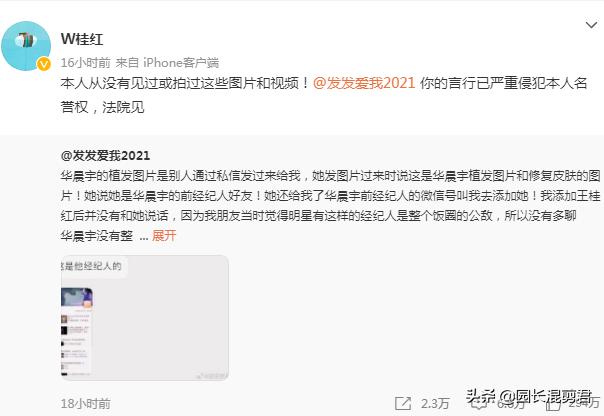 华晨宇回应植发,曝华晨宇植发真的假的