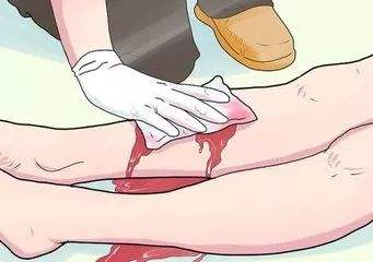 伤口撒盐的时候,伤口撒盐正确吗