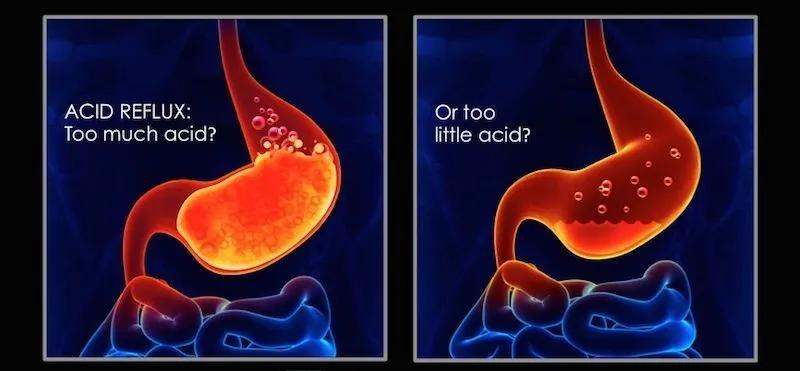 消化不好，百病生，科学提高胃酸13招，解决一半小毛病