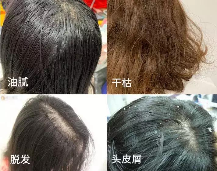 洗发水推荐控油蓬松樱花,claynal樱花洗发水推荐