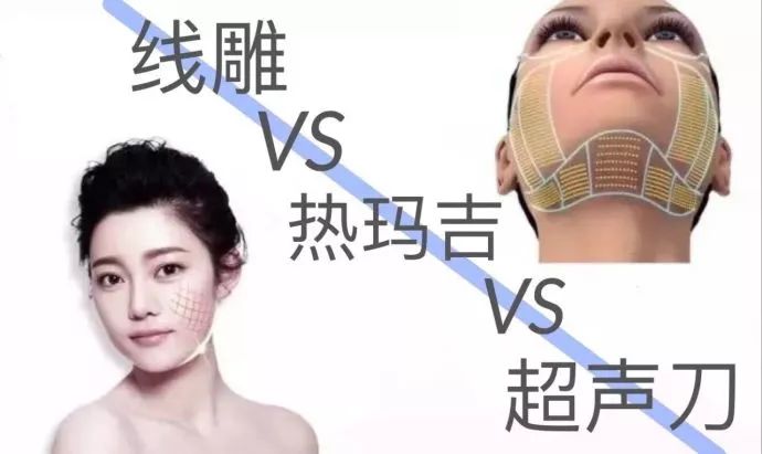 线雕热玛吉拉皮超声刀的区别,热玛吉超声刀线雕后遗症有多严重