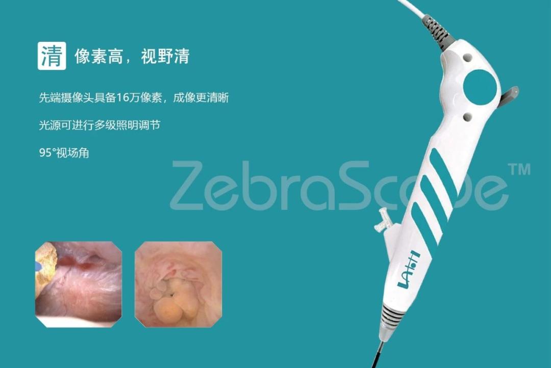 输尿管电子软镜,江苏一次性输尿管软镜