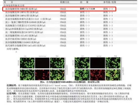 18岁得精神分裂症的原因,18岁精神分裂症患者真实视频