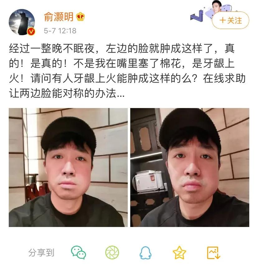 俞灏明牙龈上火原因,俞灏明牙龈上火了吗