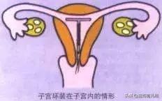 产后大姨妈没来就不用避孕?你还在信?是时候该反省下自己了