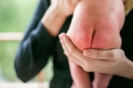 怪不得宝宝总是红屁屁,原来是这里出了问题!