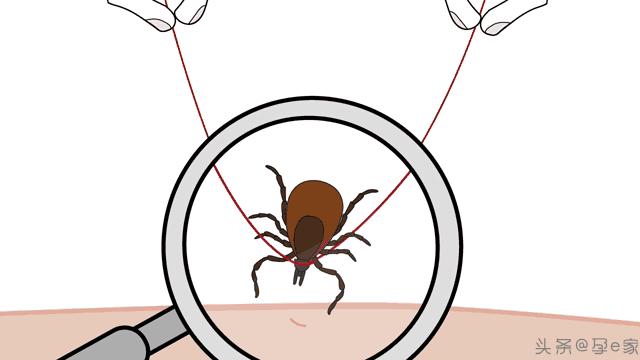 身上出现许多小黑痣,身上出现凸起黑痣一定要重视