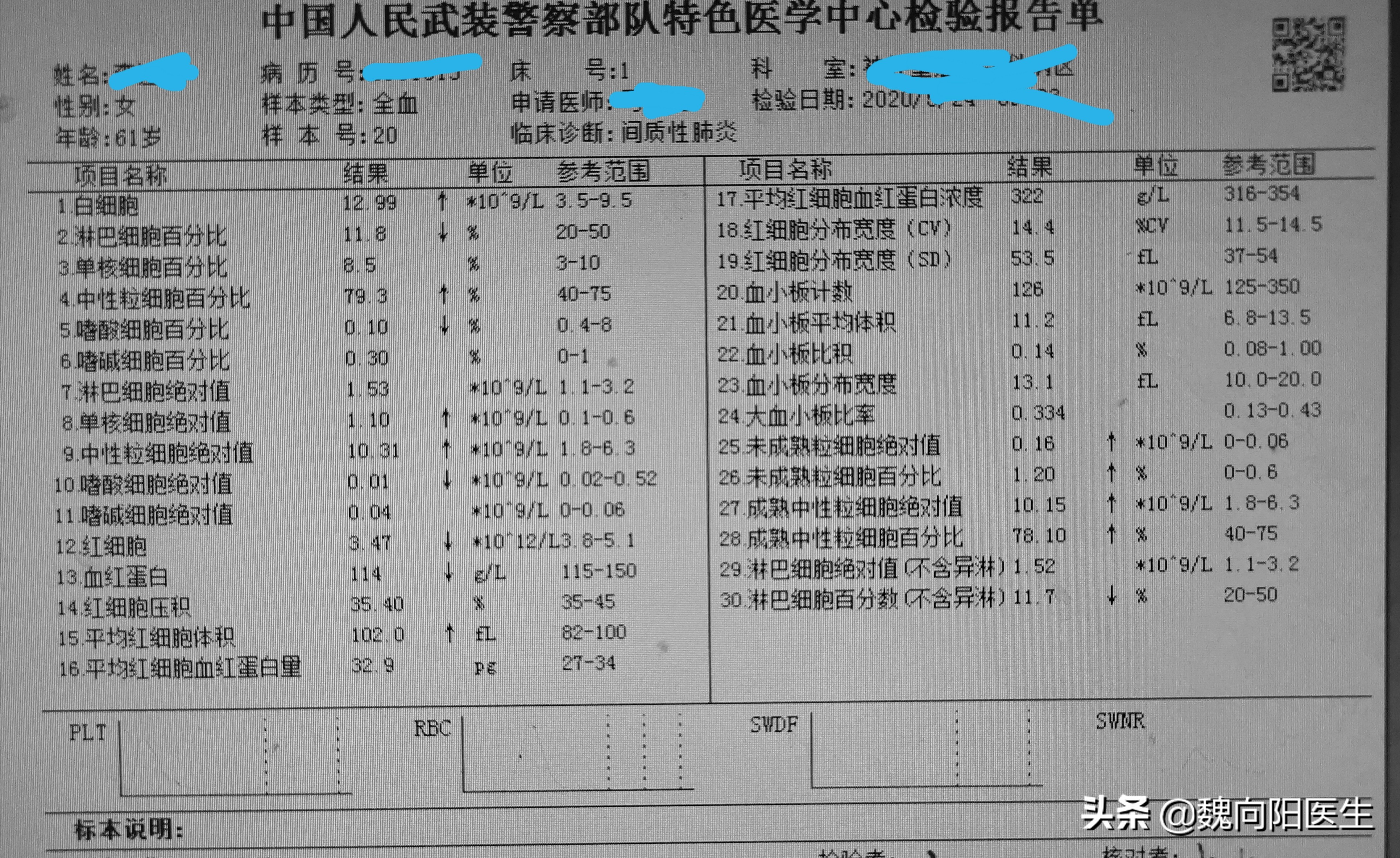 教你看懂血常规,一招教你看懂血常规检验报告单