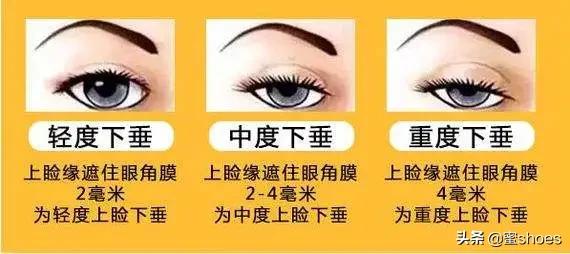 4个让你变美的脸部动作,教你4个变美动作