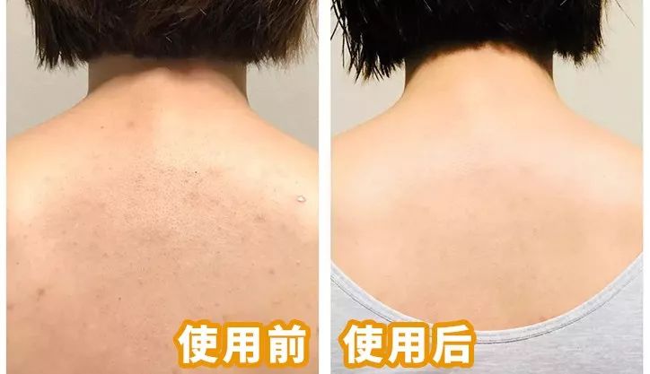 黑皮克星上线！澳洲销量第一羊奶皂，马云点赞，李佳琦直播打call