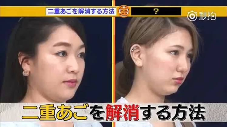 双下巴如何打造小v脸,双下巴详细教程