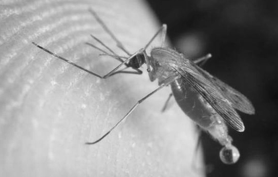 丝虫病大象腿后续,丝虫病在腿上