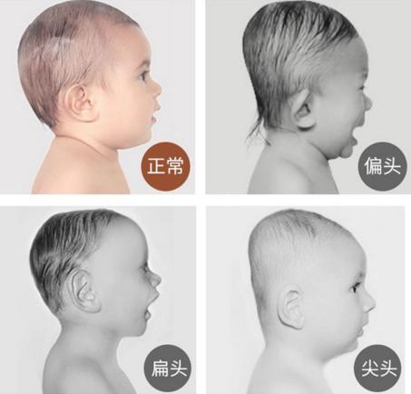 新生儿宝宝怎么睡头型好看,新生儿头型睡偏了怎么纠正