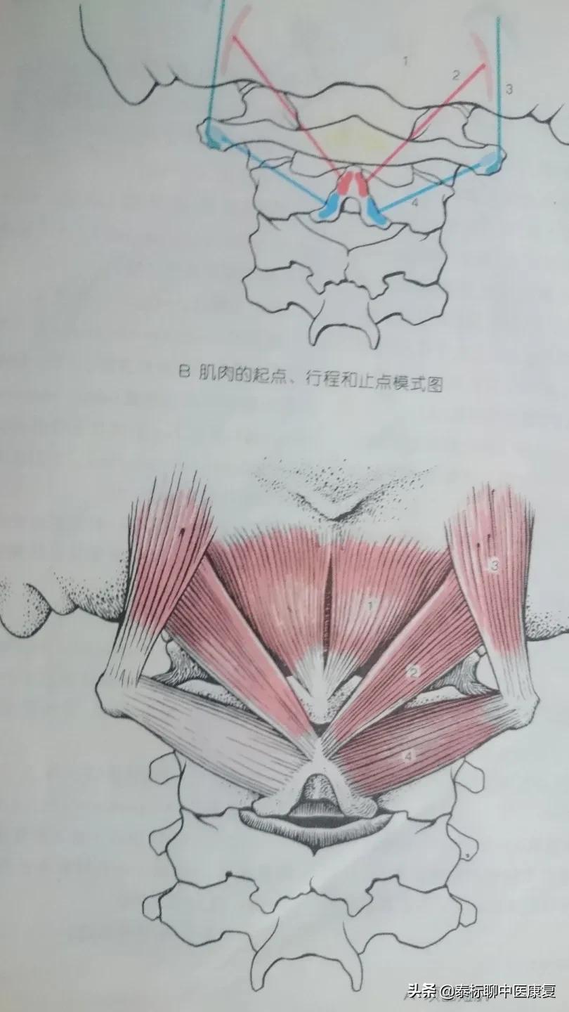 头晕失眠颈椎发紧,颈椎引起的头晕