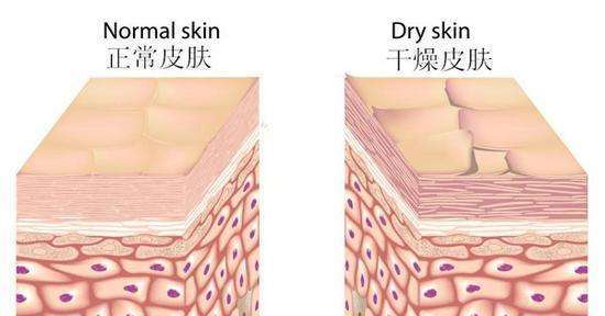 白富美就得靠补水！只知道敷面膜可不一定能得到好的效果