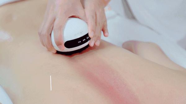 不用火的拔罐器视频,不用火自制拔罐神器