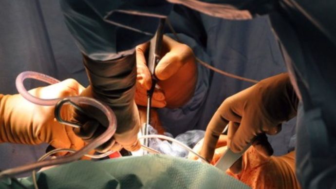 卵巢畸胎瘤是不是怪胎,卵巢恶性畸胎瘤化疗后几年算痊愈