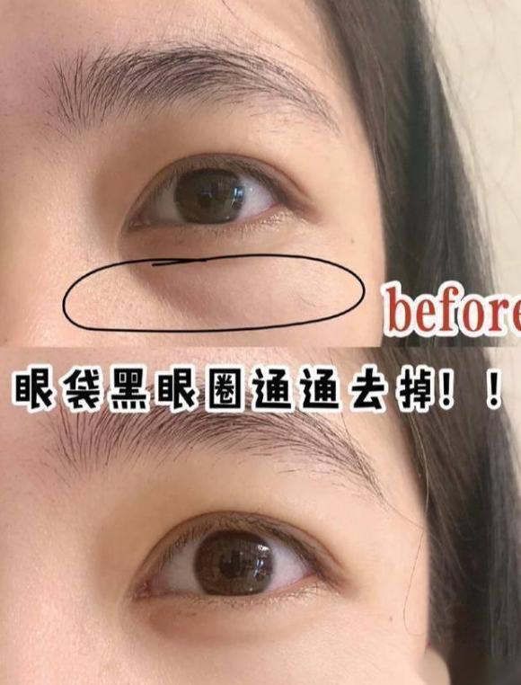 眼霜不是越贵就越好,年轻肌肤适合的眼霜