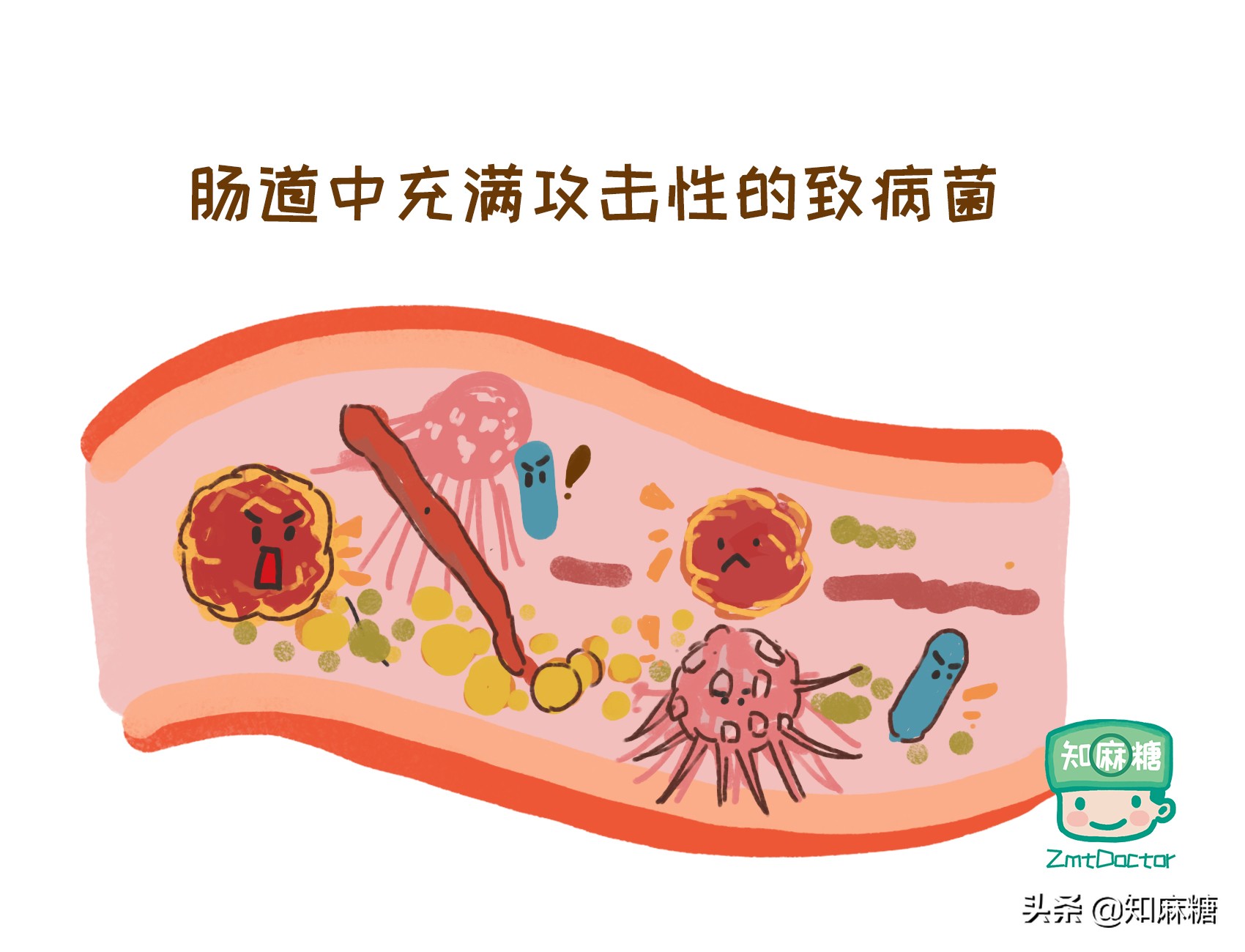剖宫产又多了一宗罪，造成新生儿肠道菌群发育不良？