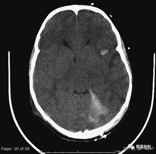 值夜班需要注意什么身体健康,值夜班的十大危害
