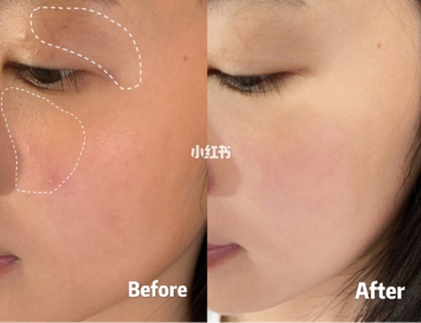 小黑瓶和小绿瓶的精华液哪个好用,小紫瓶精华液第五代和第四代区别