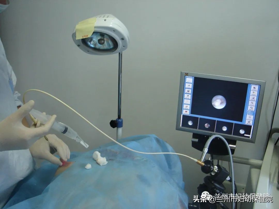 什么叫乳管镜检查,乳管镜检查操作与步骤