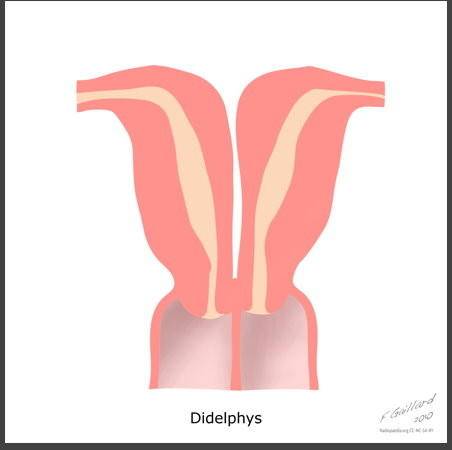 拥有双子宫的女人可以怀孕吗?会影响正常生活吗?