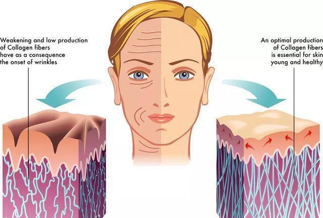 为什么抬头纹显得人这么老,多年的抬头纹怎么解决