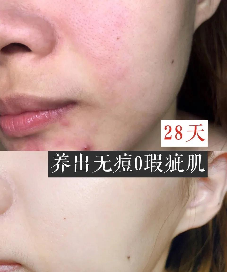 「好评反馈来啦」疯狂打call，实力表白｜为什么*干粉冻**这么受欢迎