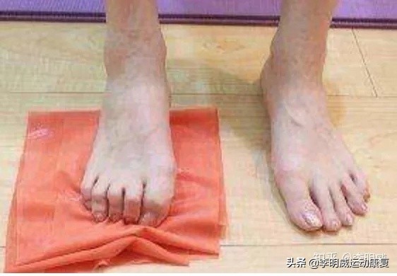 足跟痛的自我治疗方法,足跟痛艾灸的治疗方法